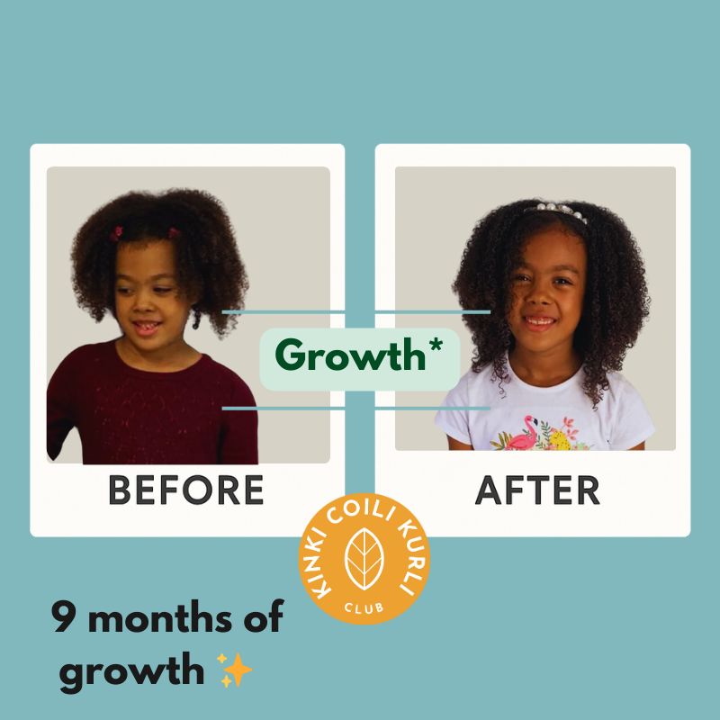 Root2Tip Starshine Hair & Scalp Growth Oil for Children — Natural Kids Hair Oil